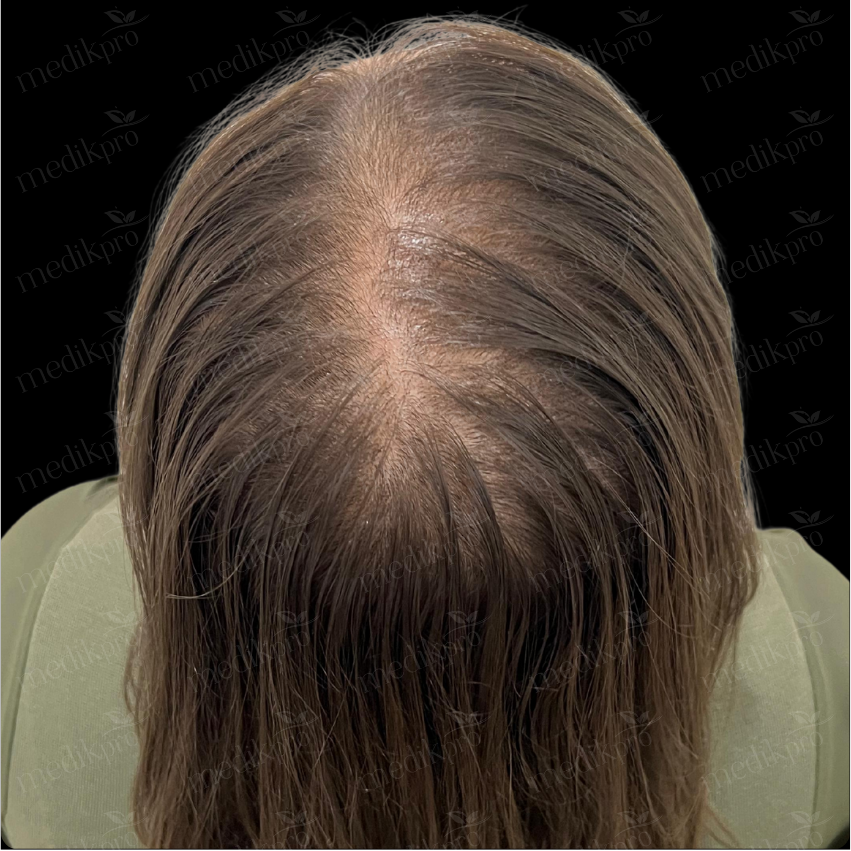 Image After