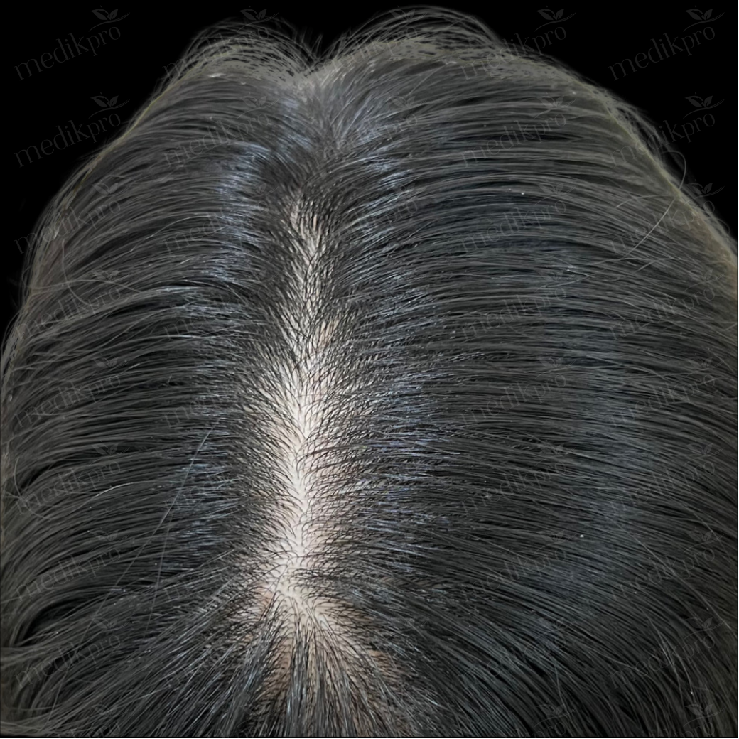 Image After