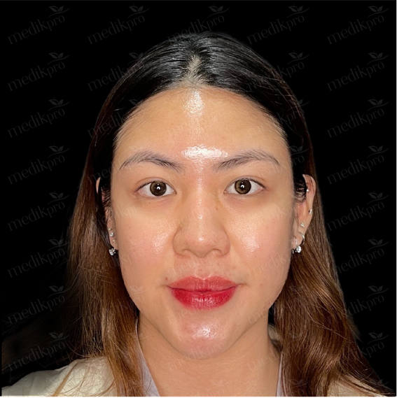Image Before