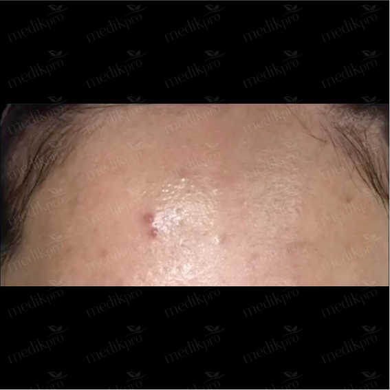 Image After