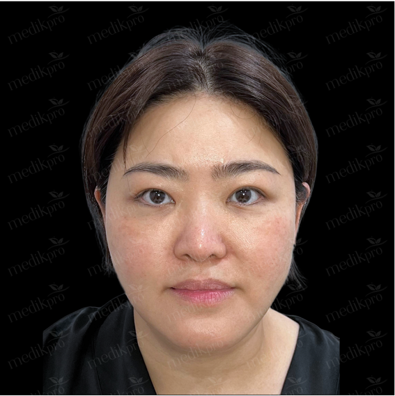 Image Before