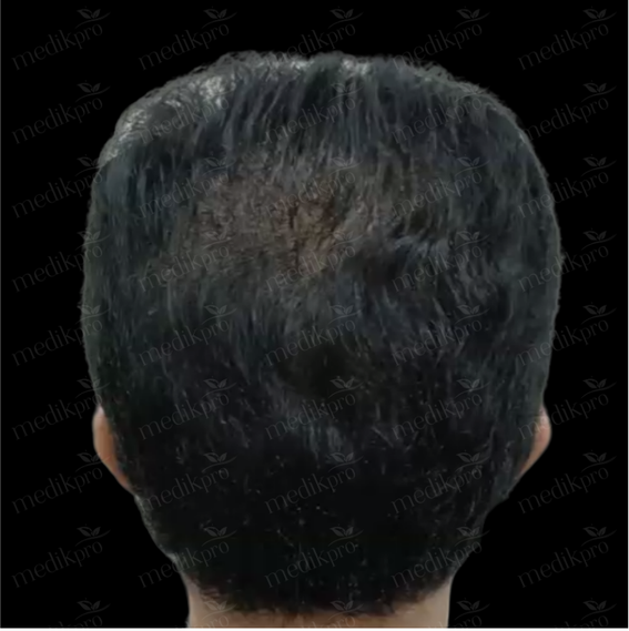 Image Before
