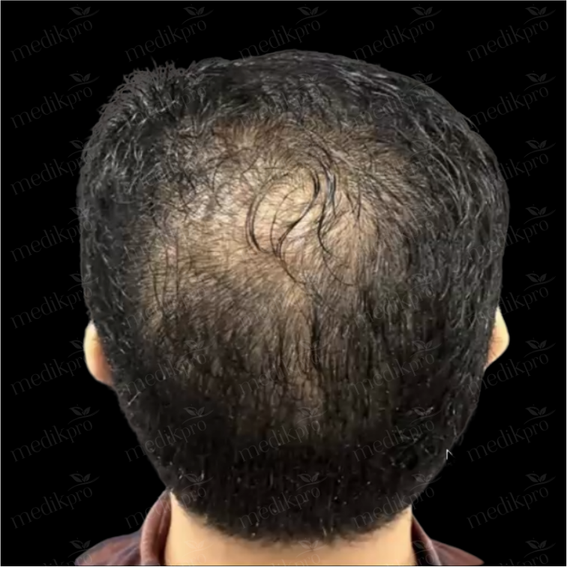 Image After