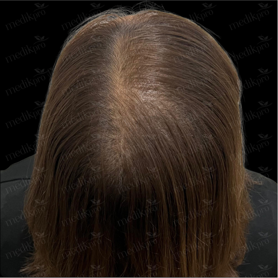 Image Before