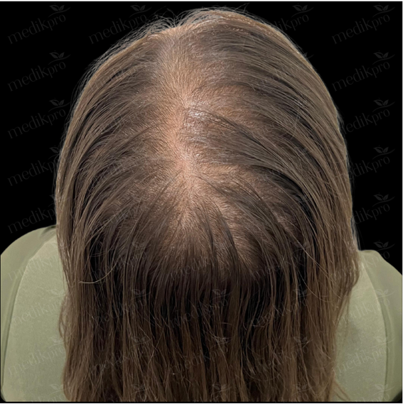 Image After