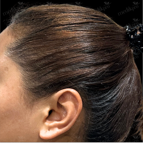 Image Before