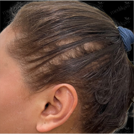 Image After