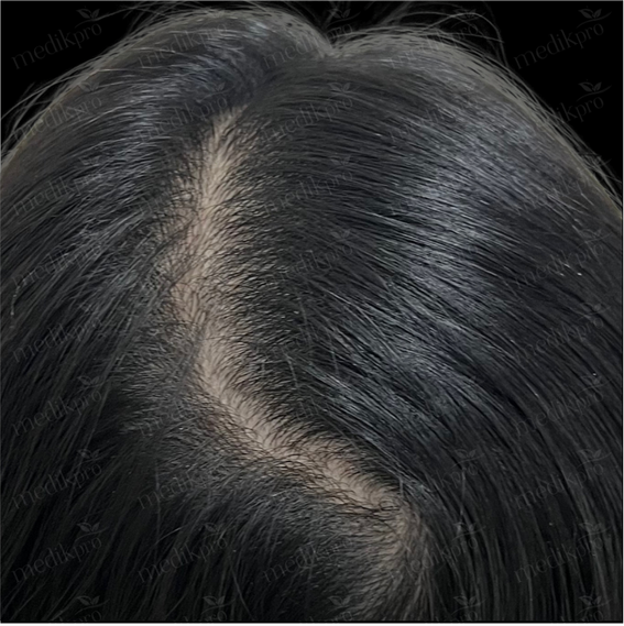 Image Before