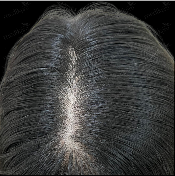Image After