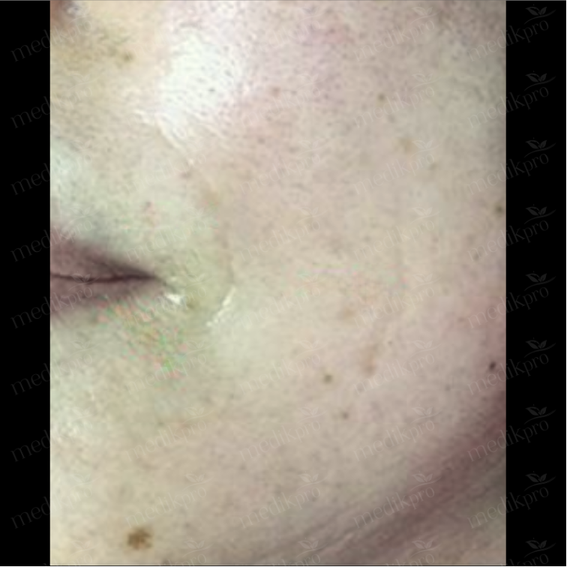 Image Before