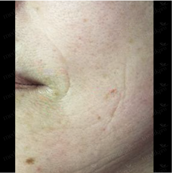 Image After