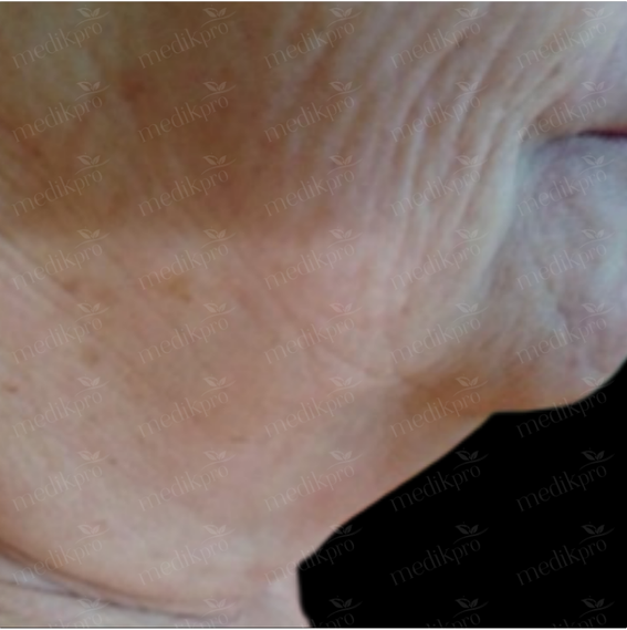 Image After