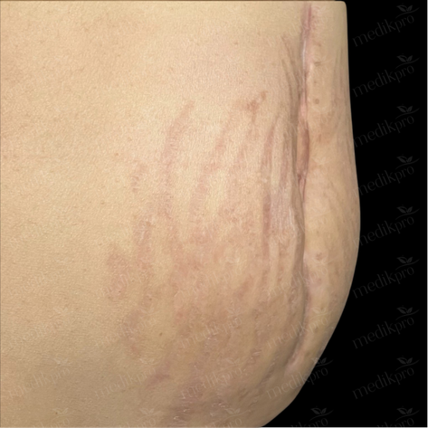 Image Before