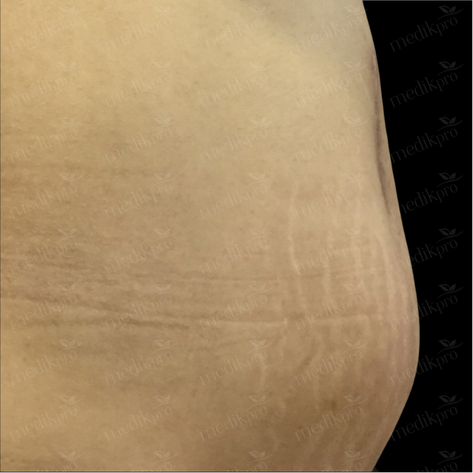 Image After