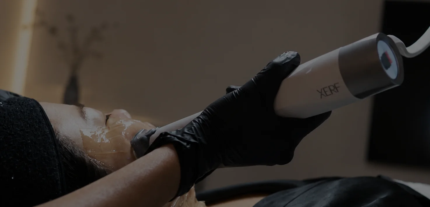 XERF is Worth it